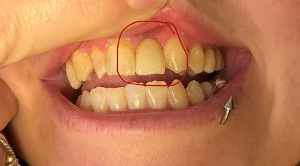 Aspen Dental - Clovis, CA