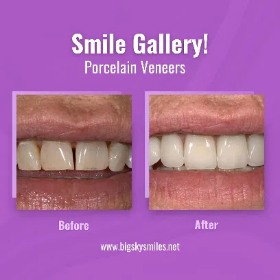 Thomas Smile Designs